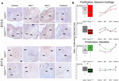 Meckel’s Cartilage in Mandibular Development and Dysmorphogenesis